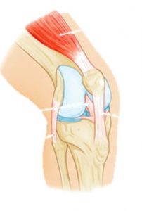 knee 2