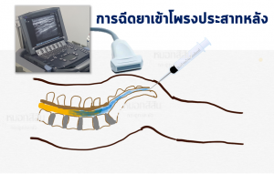 EDSI ไทย1